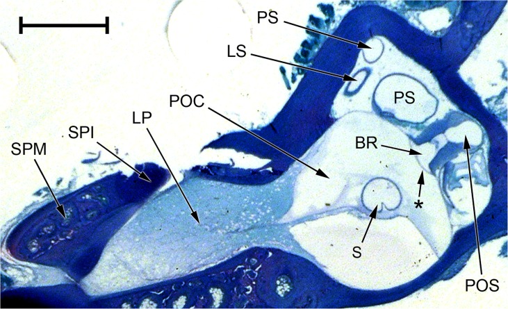 FIG. 11