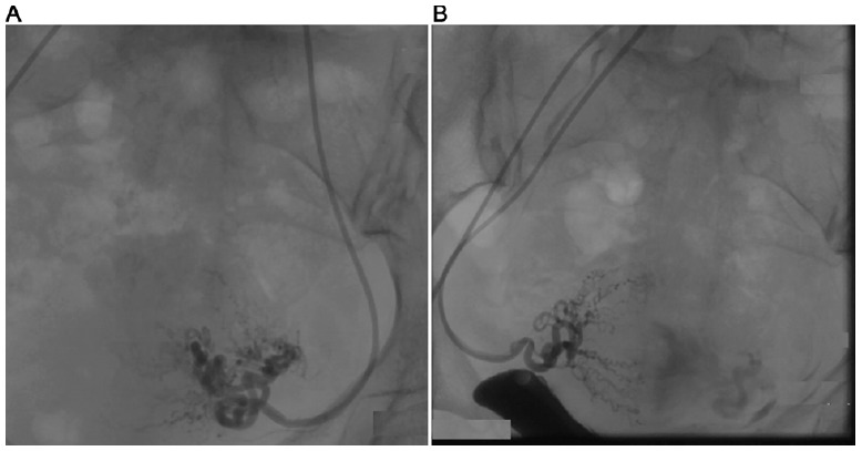 Fig. (1)