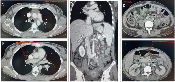 graphic file with name mmc2_lrg.jpg