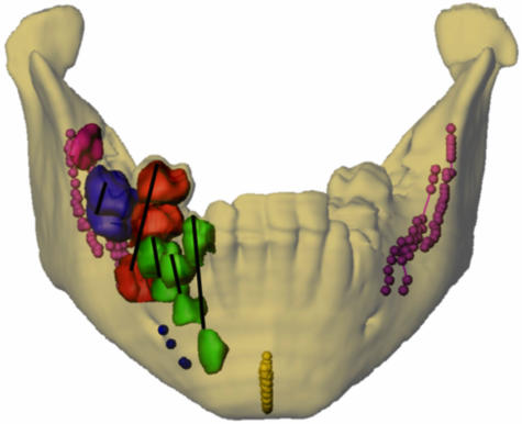 Fig. 11