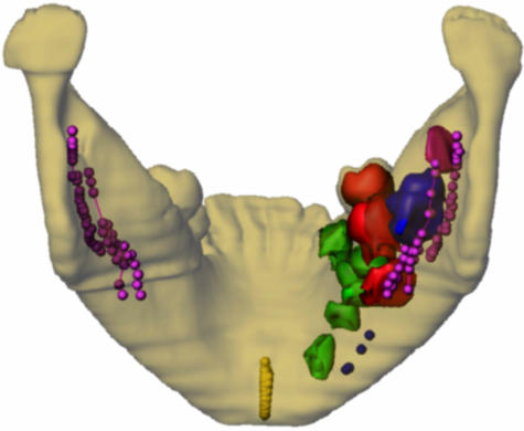 Fig. 12