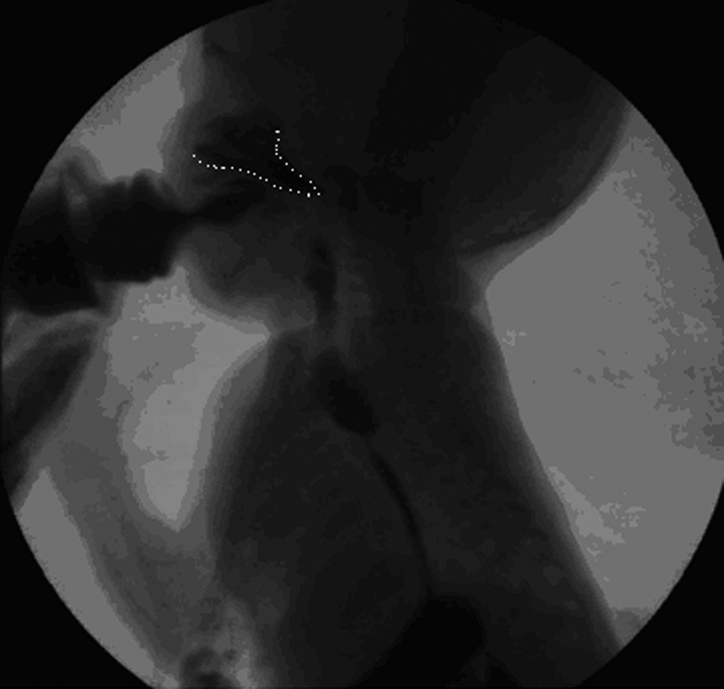 Fig. 10