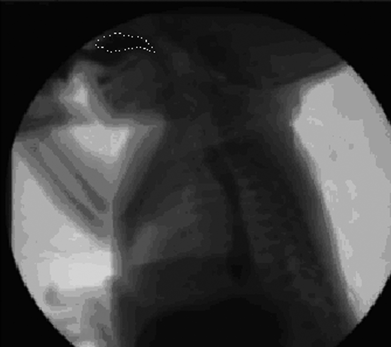 Fig. 6