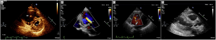 FIGURE 6