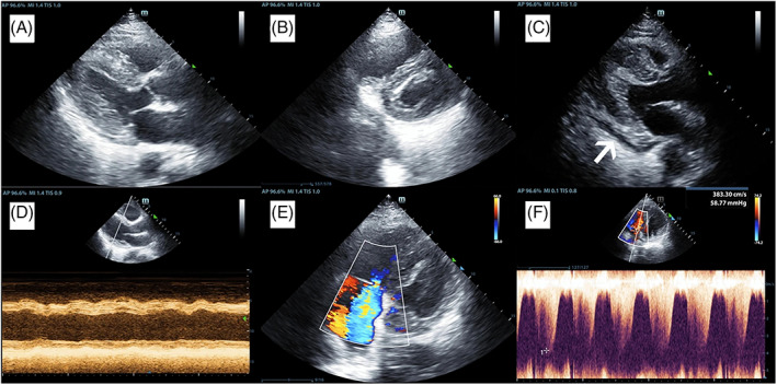 FIGURE 5