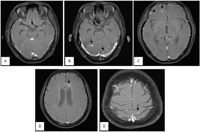 Fig 3 –