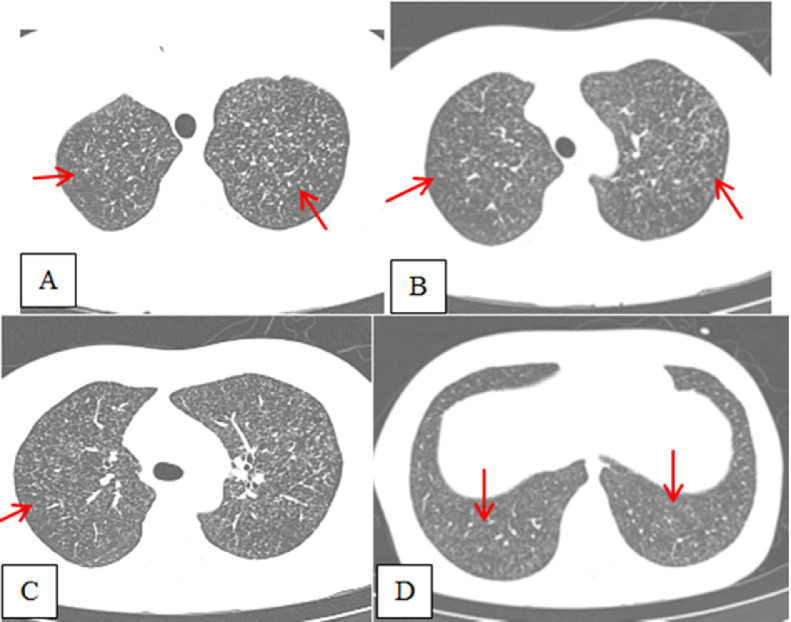 Fig 2 –