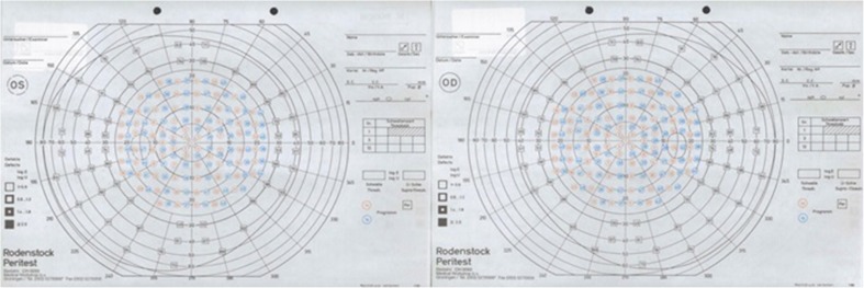 Fig. 2