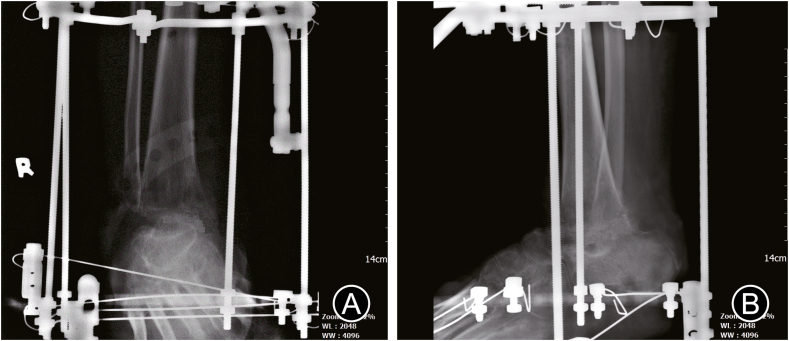 Fig. 5