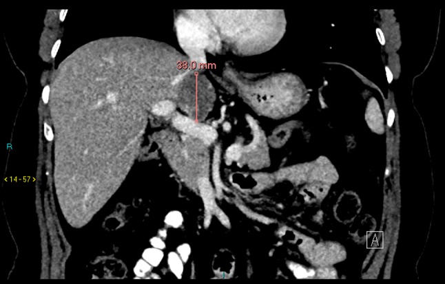 Fig. 2