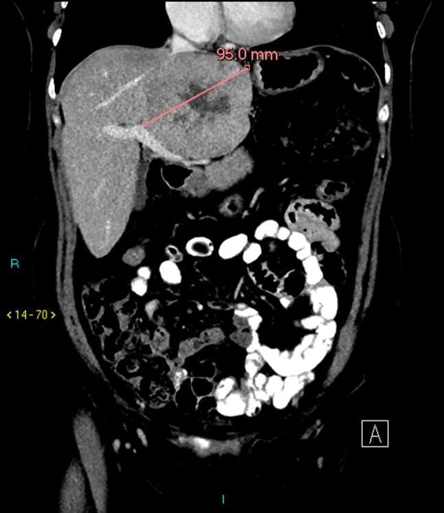 Fig. 1