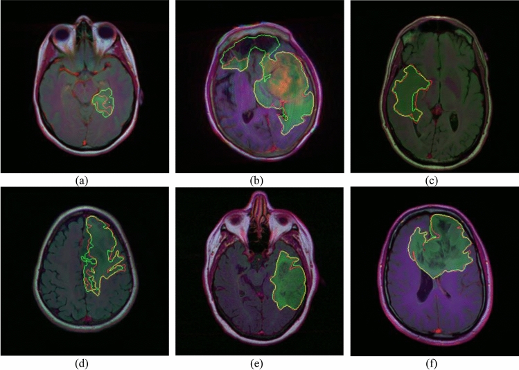 Figure 23