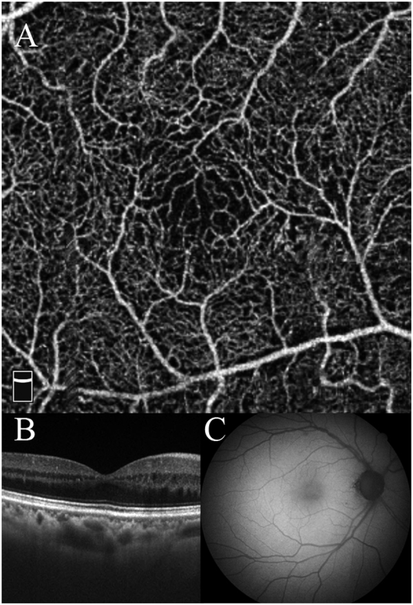 Fig. 2