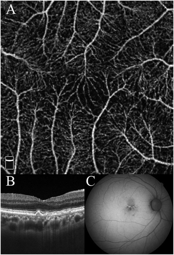 Fig. 3