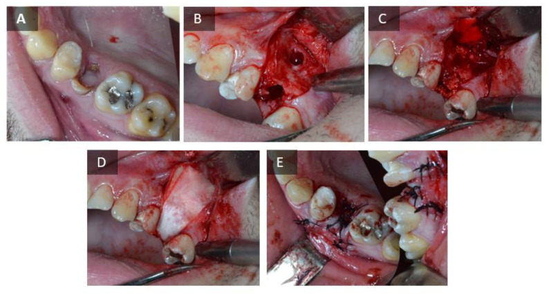 Figure 10