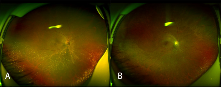 Fig. 4