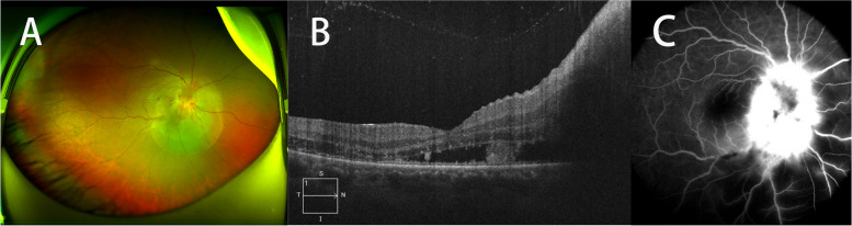 Fig. 1