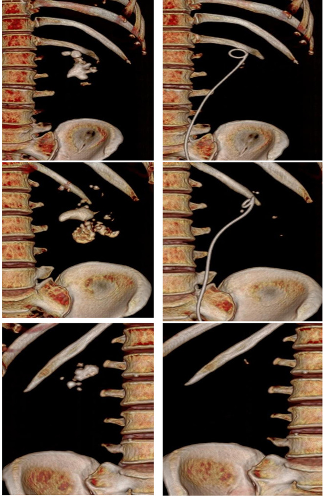 Fig. 2