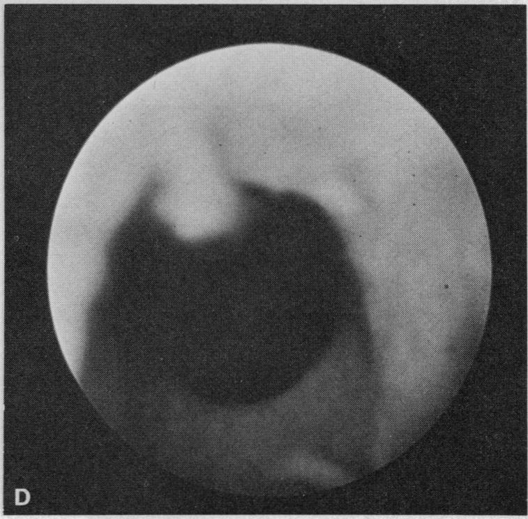 Figure 3. D