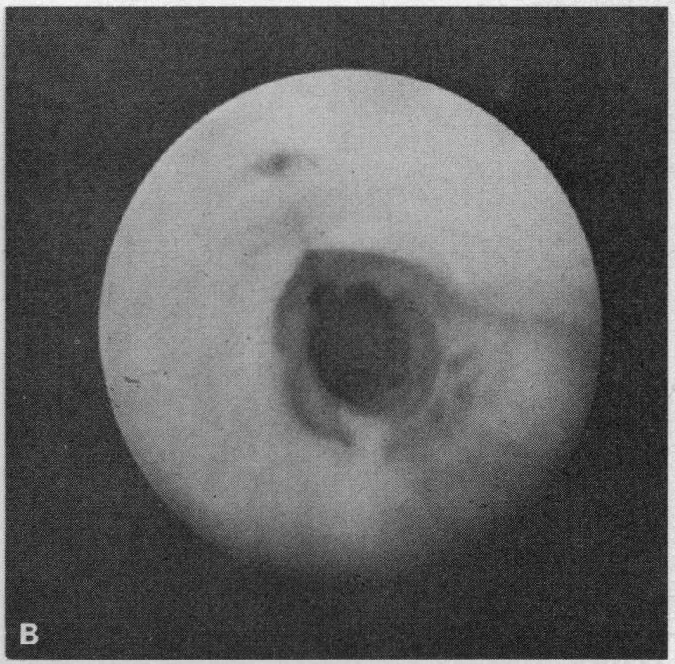 Figure 3. B