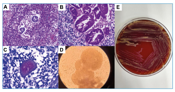 FIGURE 1: