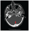 Figure 2: