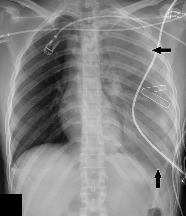 Fig. 1