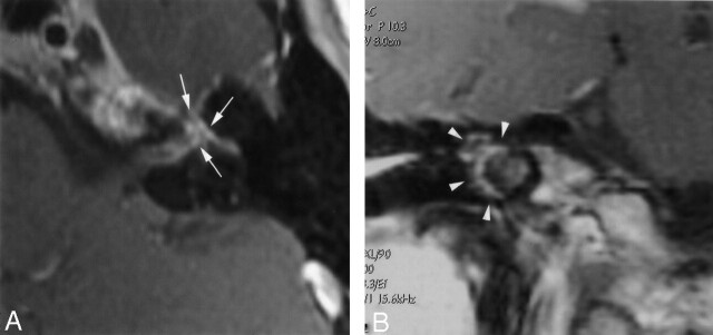 Fig 3.