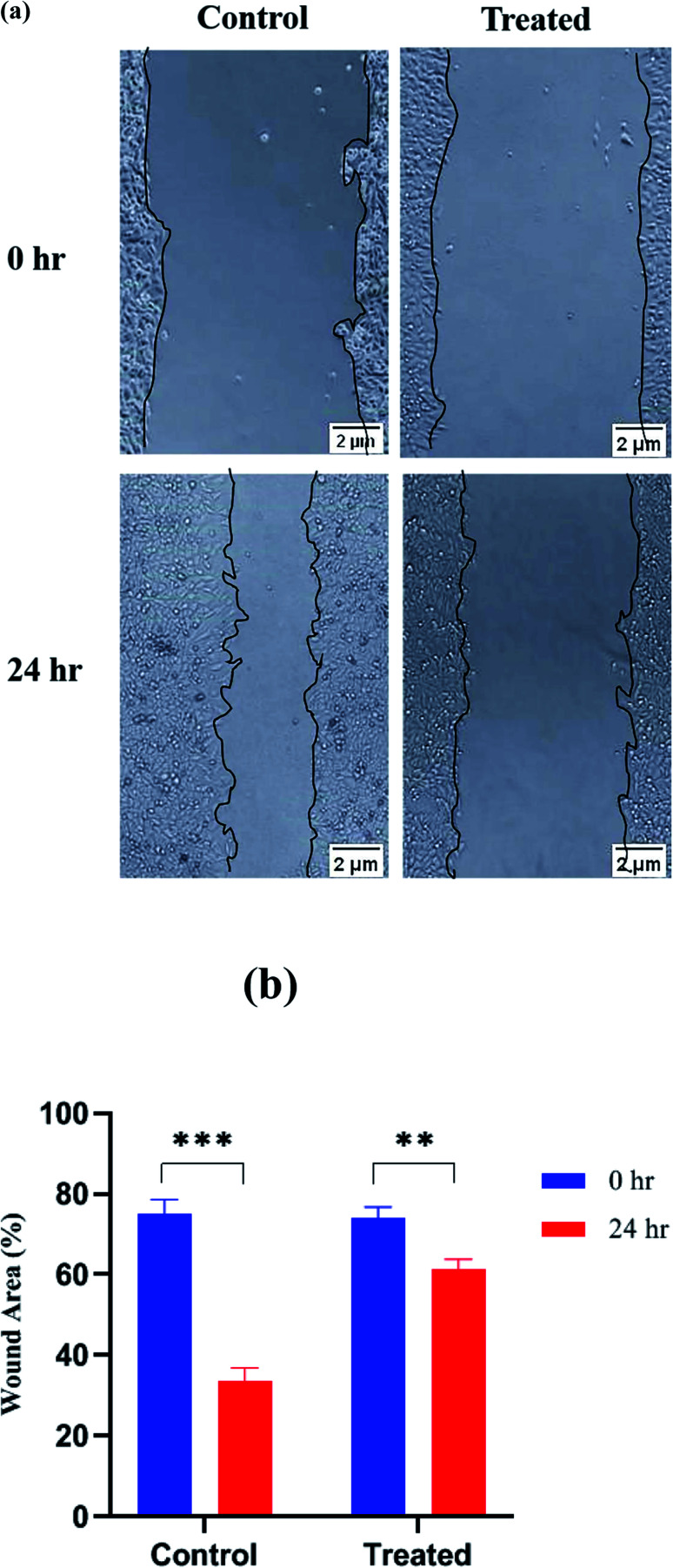 Fig. 12