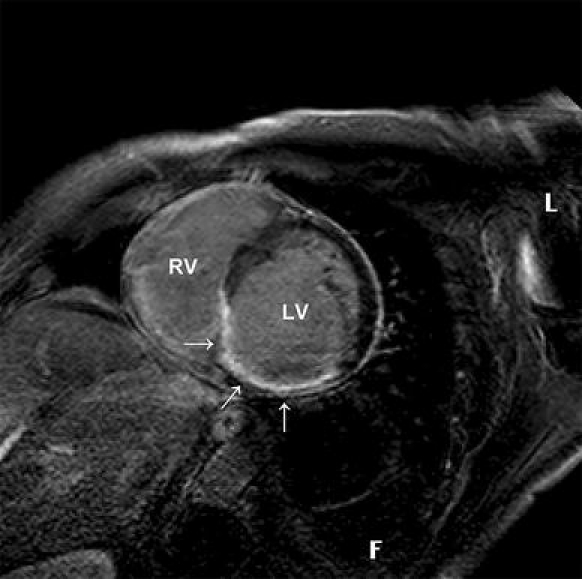 Fig. 3