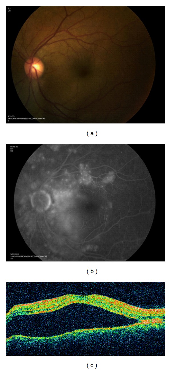 Figure 3