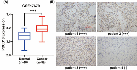 graphic file with name CAM4-12-1673-g005.jpg