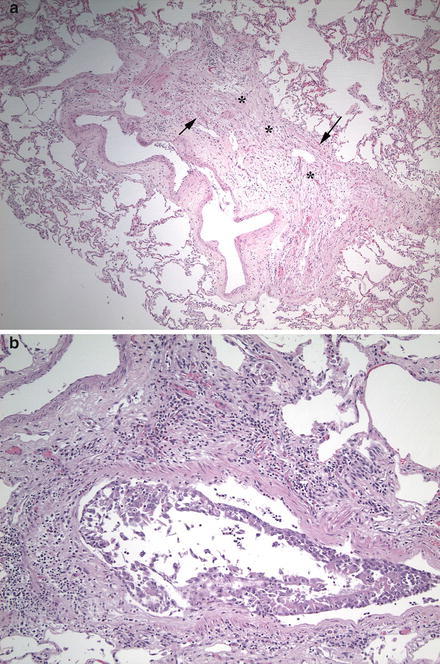 Fig. 2.5