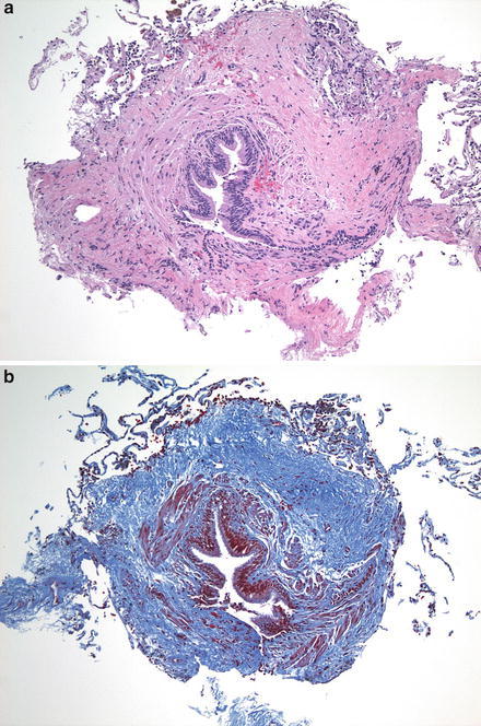 Fig. 2.4