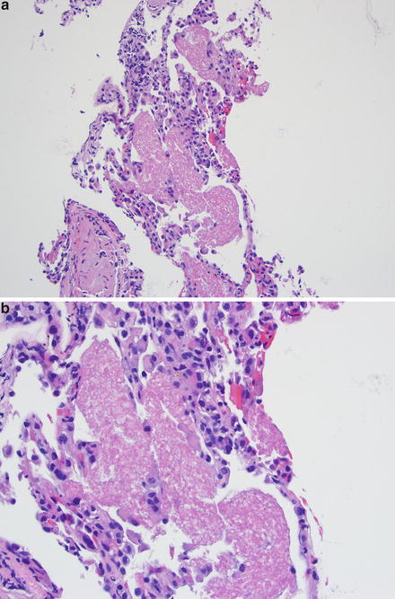 Fig. 2.9