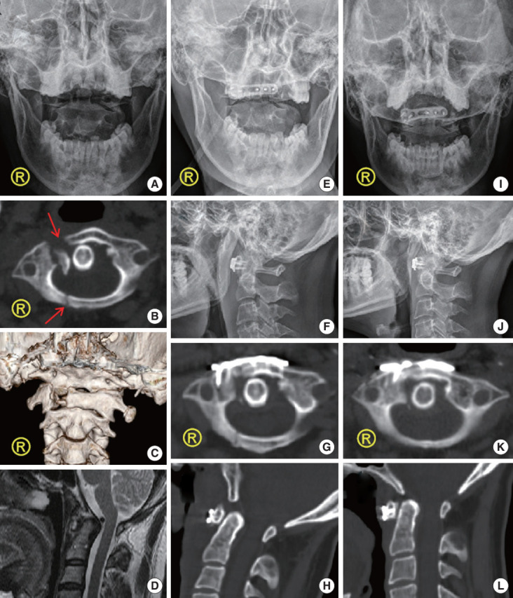 Fig. 2.