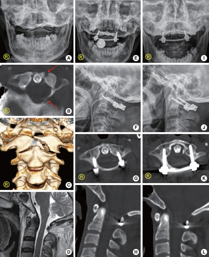 Fig. 4.