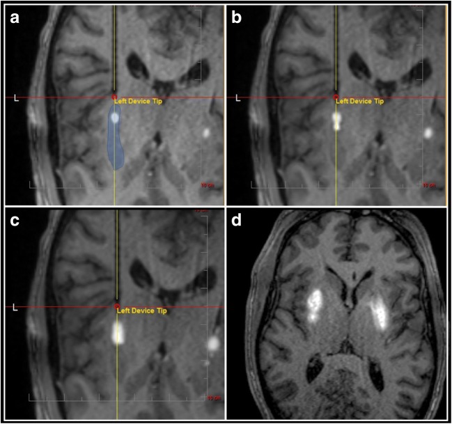 Fig. 3