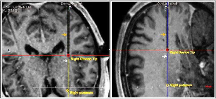 Fig. 2