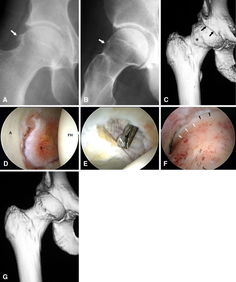 Fig. 3A–G