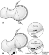 Fig. 1A–B