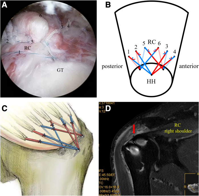 Fig 12