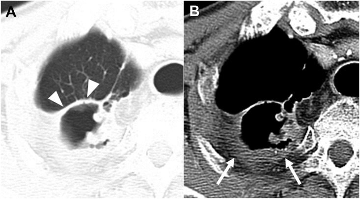 Fig 5