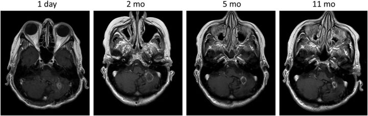 Fig 3.