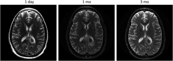 Fig 4.