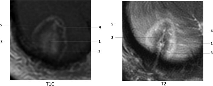 Fig 2.