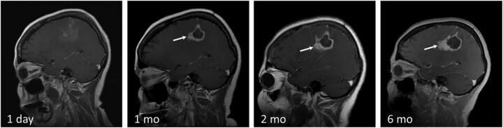 Fig 5.