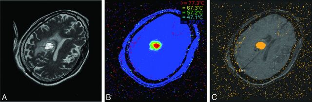 Fig 1.