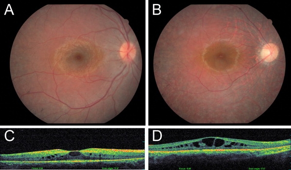 Figure 3