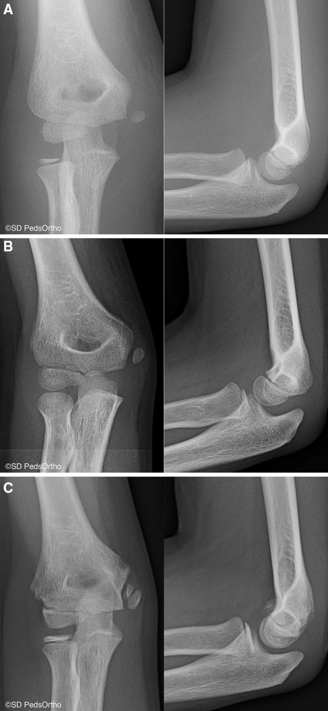 Fig. 2